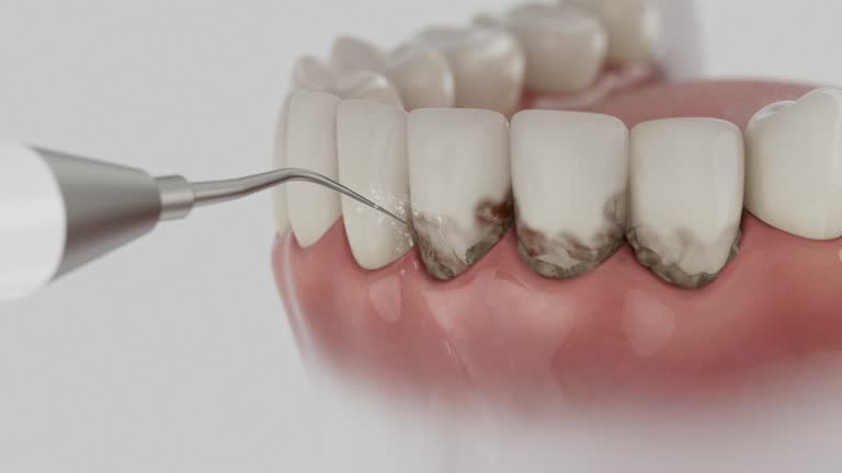 Reliable Dental contractor in Albany, CA by Smile Center Dentistry